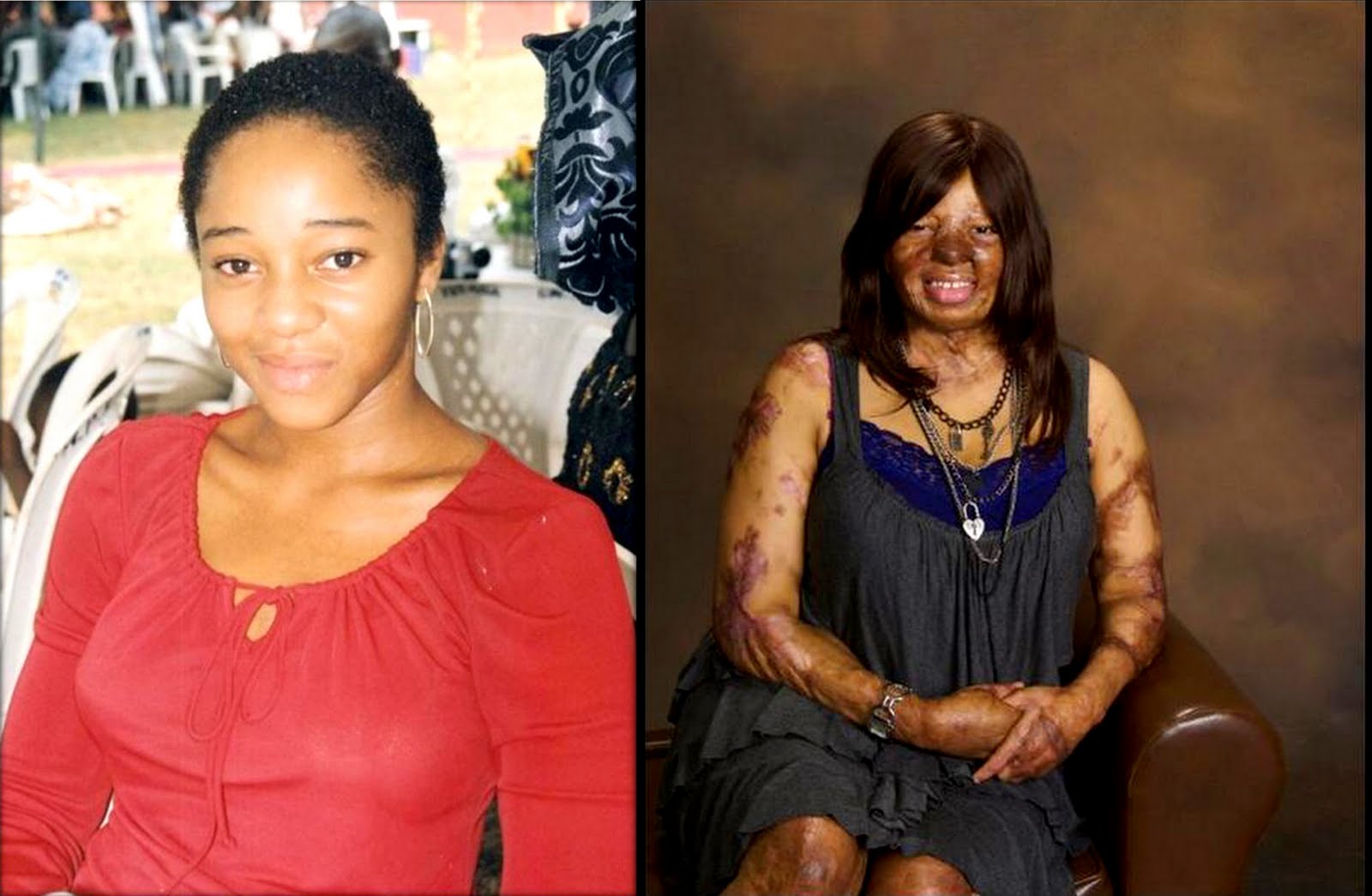Kechi Okwuchi before and after the plane crash